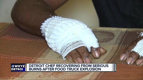 Detroit chef recovering from serious burns after food truck explosion