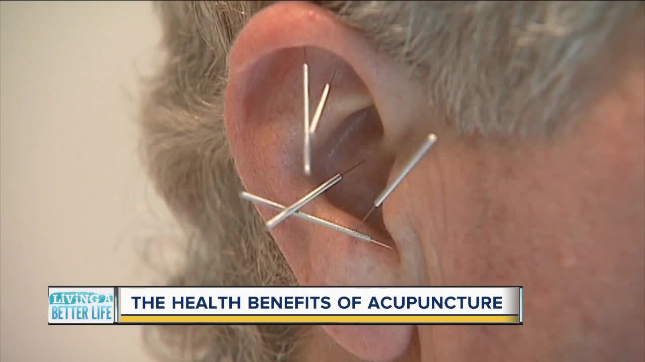 The health benefits of acupuncture