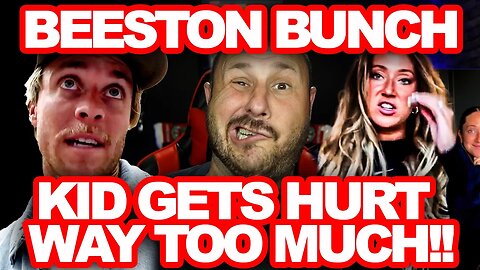 Beeston Bunch Kid Keeps Getting Seriously Injured | DO Better Hay Hair