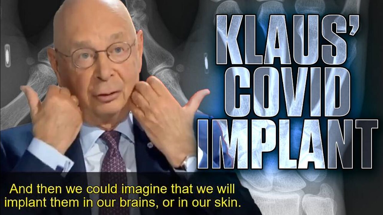 Klaus Schwab Plans To Implant Us With Microchips!