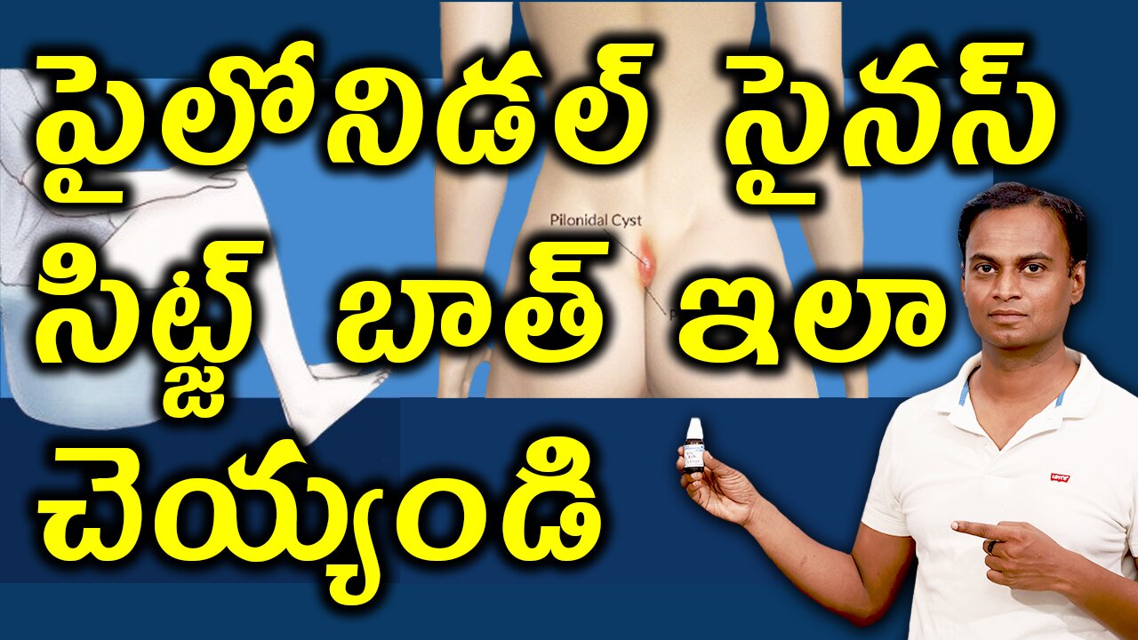 పైలోనిడల్ సైనస్ కి సిట్జ్ బాత్ ఇలా చెయ్యండి | Best Procedure for Pilonidal Sinus Sitz bath tub bath