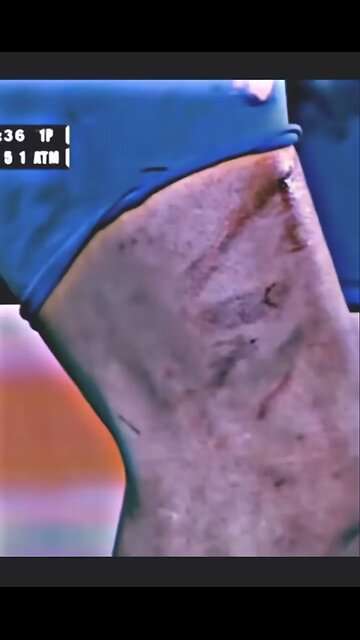 Messi insane dribbling while injured (short video)