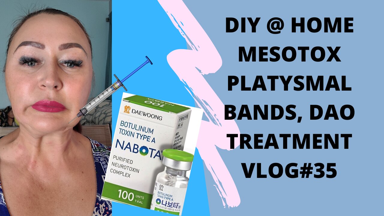 NABOTA MESOBOTOX PLATYSMAL BANDS ,DAO@ HOME VLOG#35 #botox #nabota #botoxinjections