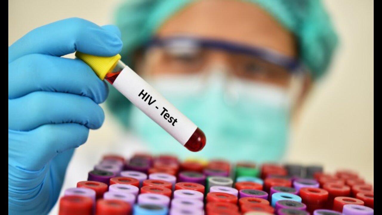 PANDEMIA AIDS, Pessoas Vacinadas Estão sendo Diagnosticadas Com AIDS.