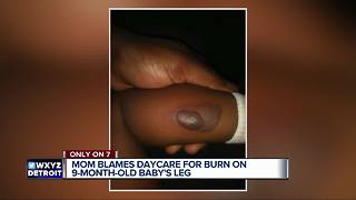 Mother angry after she wasn't told her baby was burned at Detroit daycare