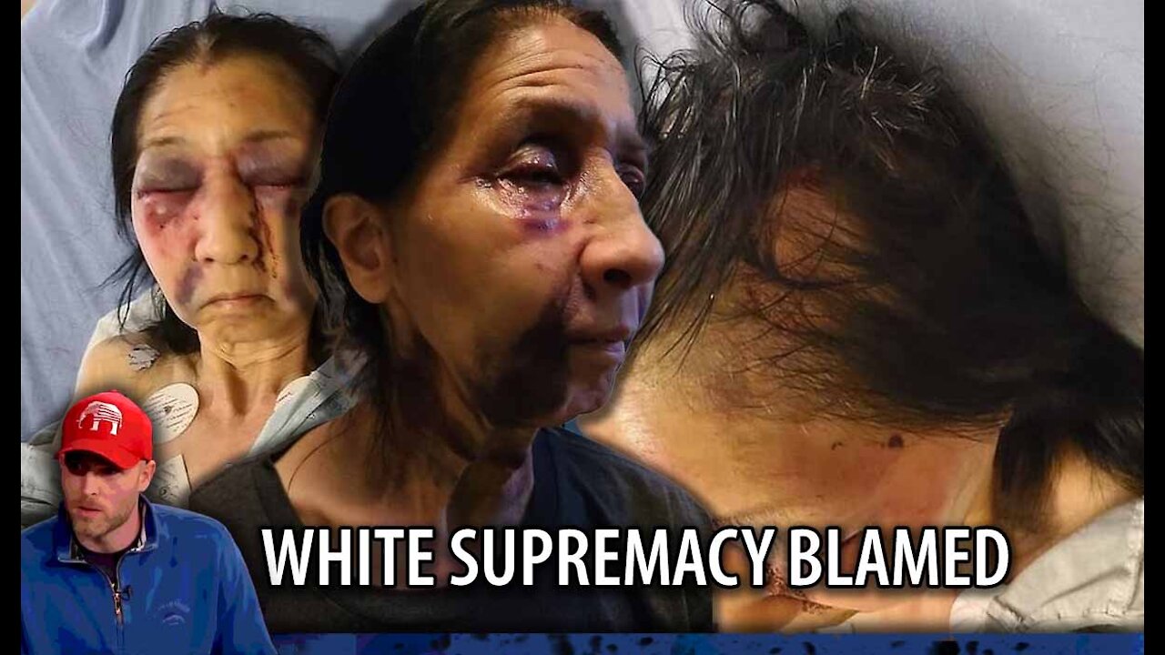 Mexican Woman BRUTALLY Assaulted by Blacks, Blamed on White Supremacy