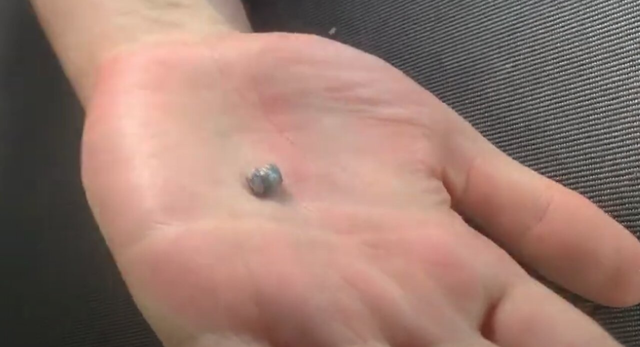 Bullet Extraction From My Truck!