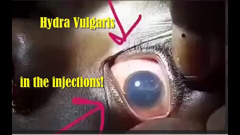 One of a number of parasites in the injections! Do not miss it! Dr. Madeij explains!