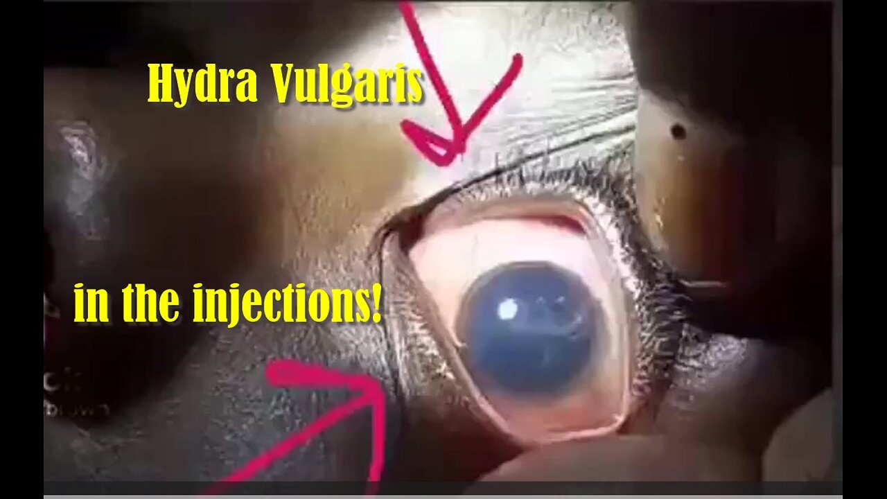 One of a number of parasites in the injections! Do not miss it! Dr. Madeij explains!