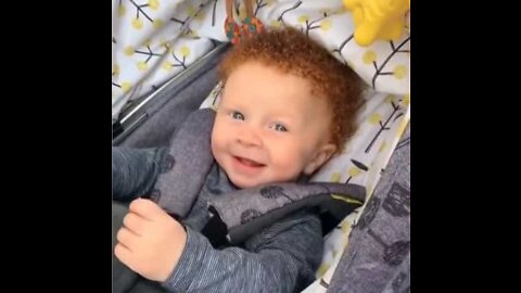 Baby amazes parents with his unique appearance