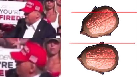 ►🚨❗️⚡️Trump Head Turn...