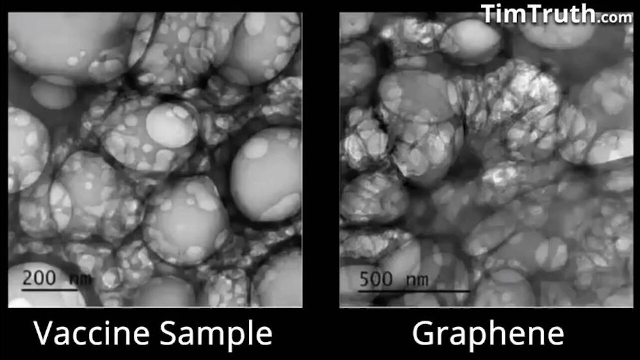 Electron Microscope Reveals Horrifying Contents Of COVID-19 Vaccine