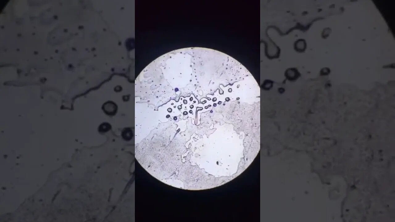 Amazing Scenes in Microscope 🔬 that is necessary to everyone for keep healthy #microscope