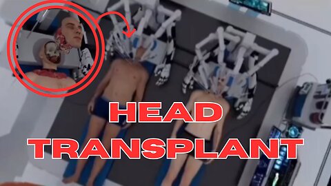 Head Transplant in Humans