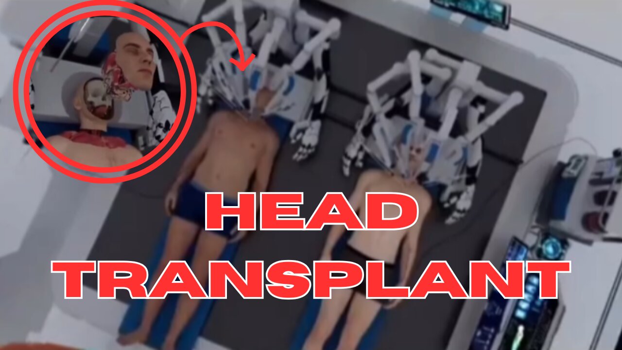 Head Transplant in Humans