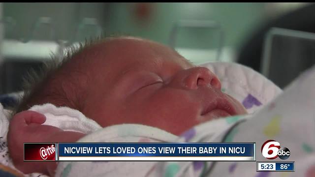 Nicview lets loved ones view their baby in NICU