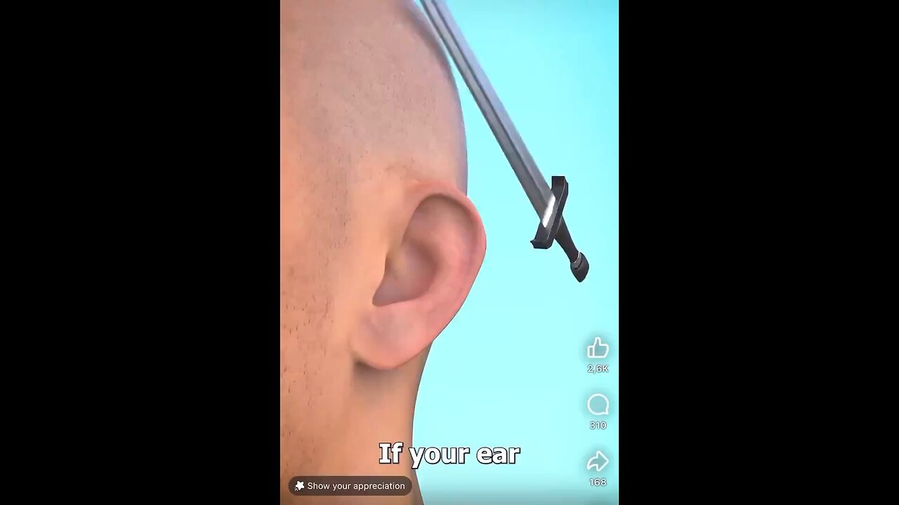 Ear accidentally get ripped off?