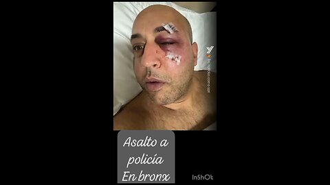 POLICÍA EN EL BRONX ASALTADO Y GOLPEADO POR UN GRUPO DE DELINCUENTES EN EL TRAIN