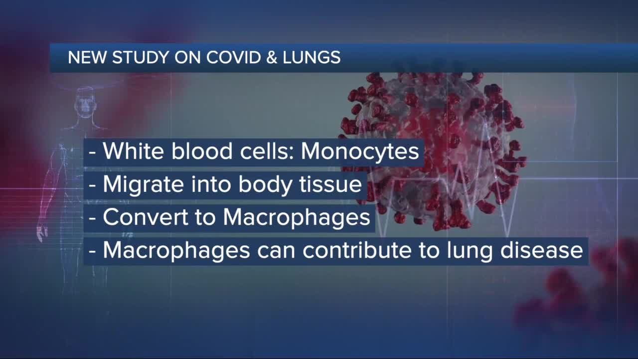 Study sheds light on how immune cells in the lungs may worsen virus attacks