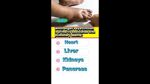 What is edema causes,sign,treatment #mcqs #edema #sweling #foodedema #pharmacologyexam #3dmedico
