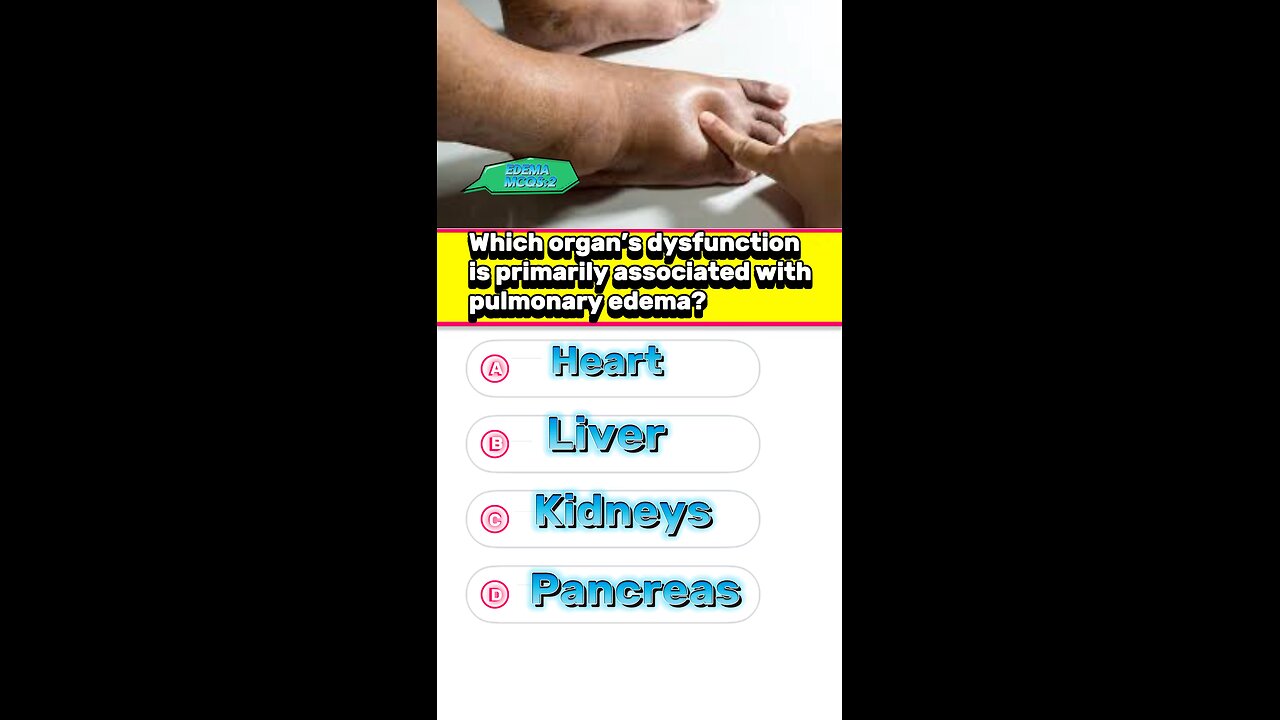 What is edema causes,sign,treatment #mcqs #edema #sweling #foodedema #pharmacologyexam #3dmedico