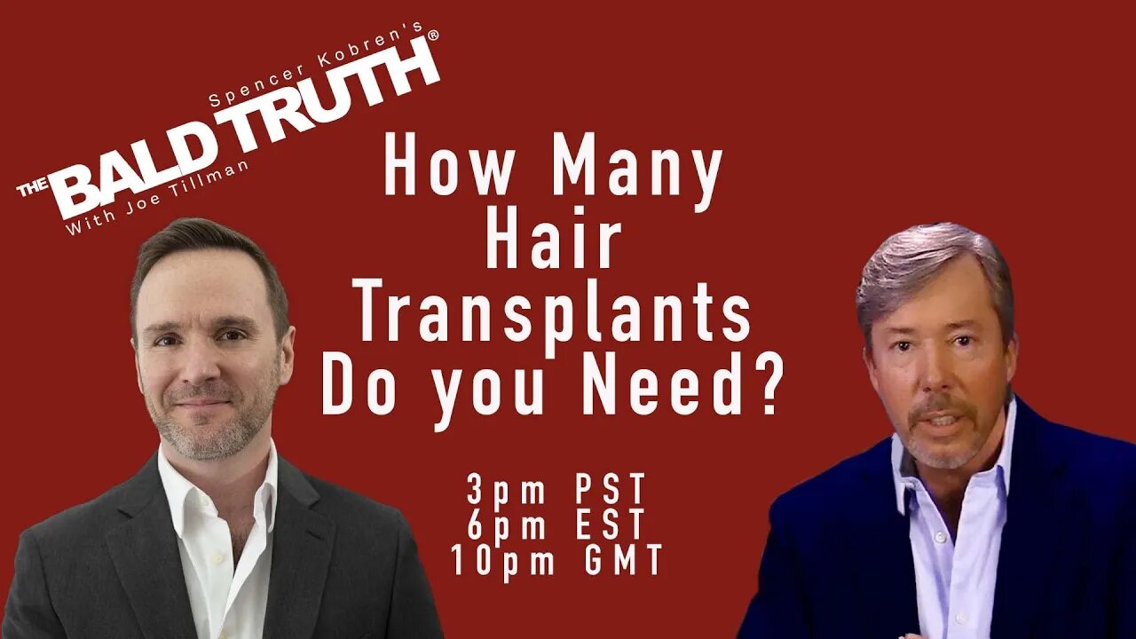 How Many Hair Transplants?- The Bald Truth - July 28th, 2023