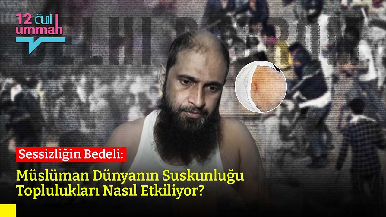 Sessizliğin Bedeli: Müslüman Dünyanın Suskunluğu Toplulukları Nasıl Etkiliyor?