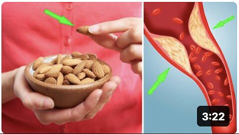 What Are the Benefits of Eating Almonds Daily