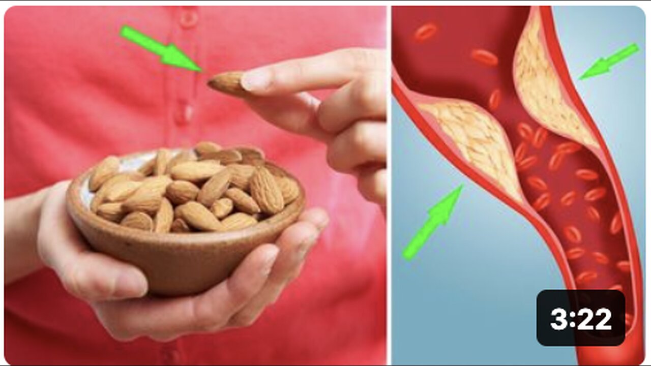 What Are the Benefits of Eating Almonds Daily