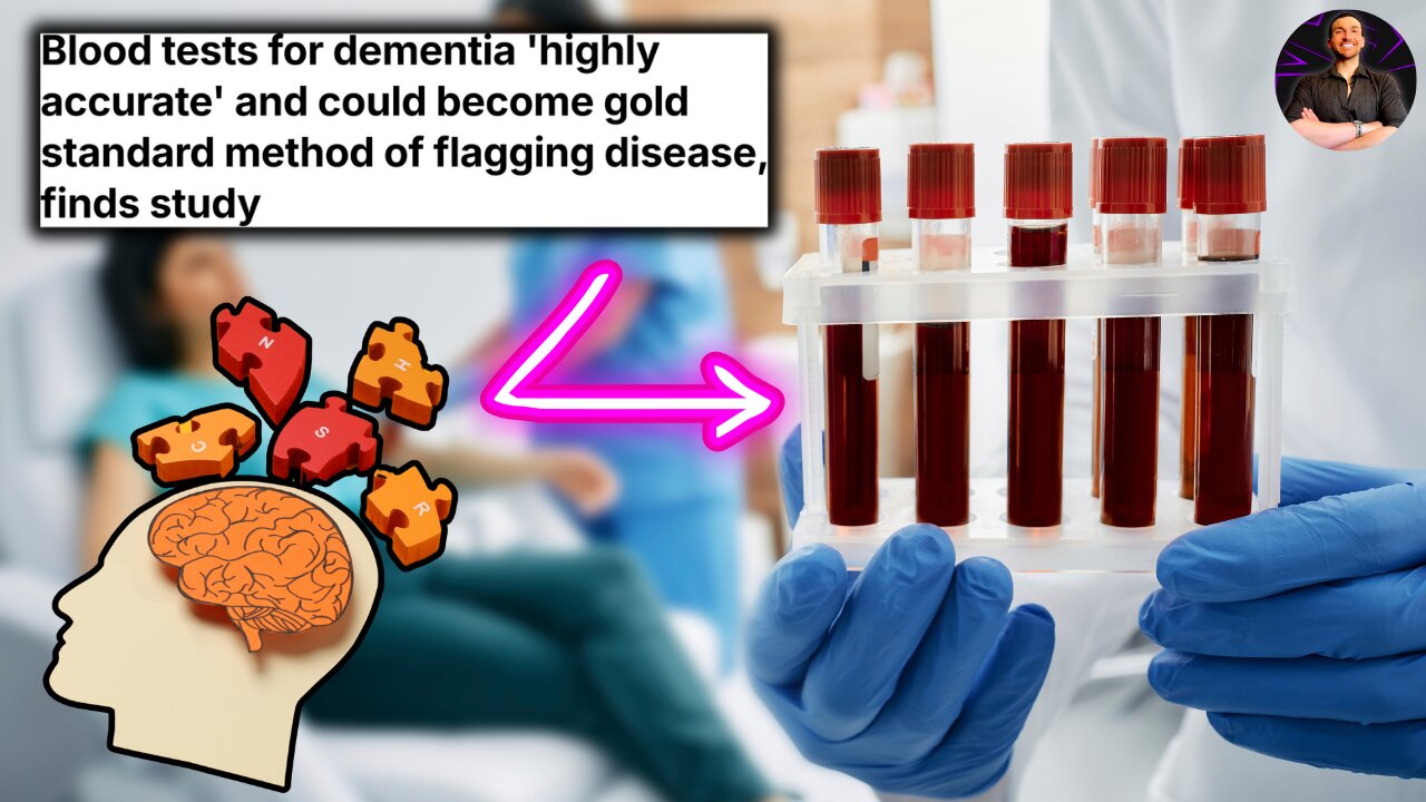 Highly Accurate Blood Test For Dementia Discovered! Help is on the Way!