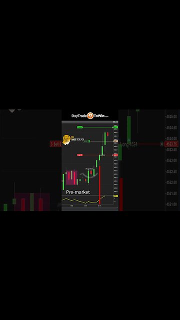 $300 Trade You Can Do #daytrading #daytradetowin #beginnertrading #scalpingstrategies