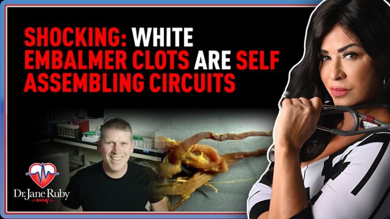 Dr. Jane Ruby SHOCKING: White Embalmer Clots Are Self Assembling Circuits