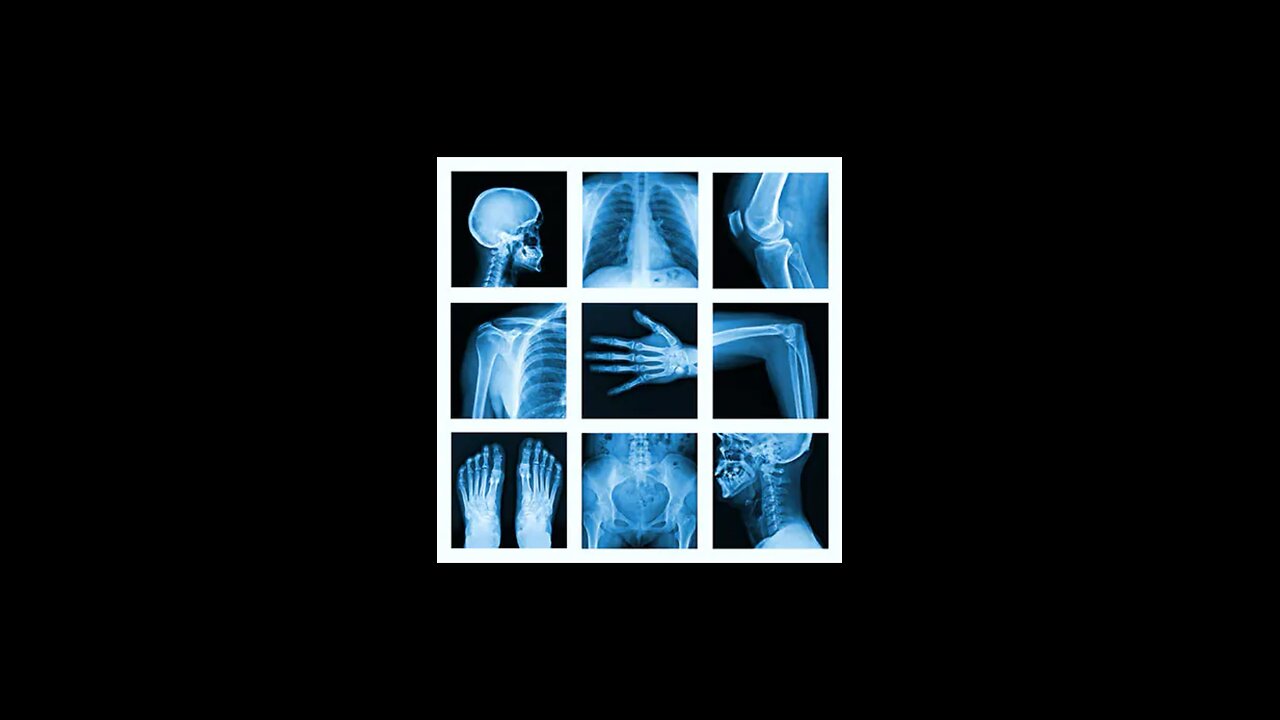 X Ray by Nolle Mason