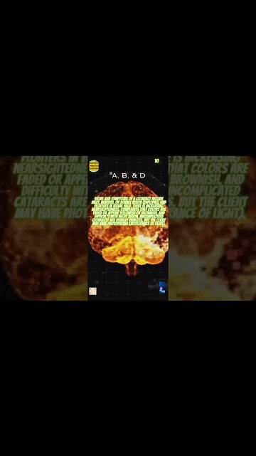 #10 Level up your NGNNCLEX skills: Neuro practice questions for success #RN #LPN #NCLEX