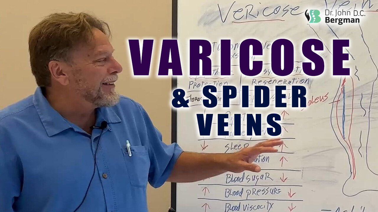 Varicose & Spider Veins