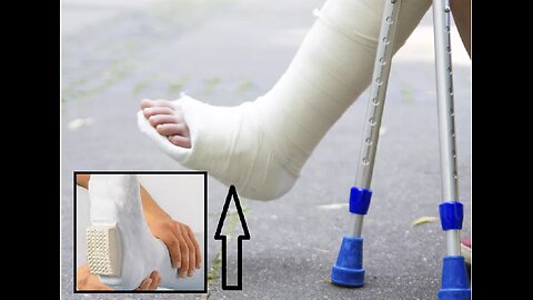 After finally obtaining hill on the gypsum for broken leg, mother again in her abusive element