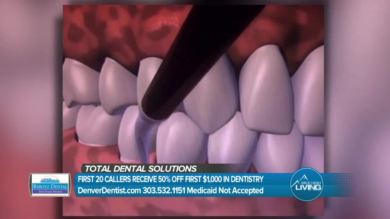 Barotz Dental- Total Dental Solutions