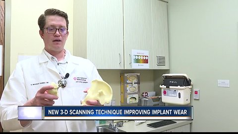 Boise State student's 3-D scanning technique could help improve hip replacement longevity