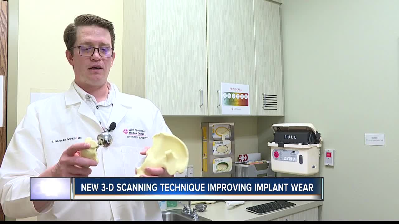 Boise State student's 3-D scanning technique could help improve hip replacement longevity