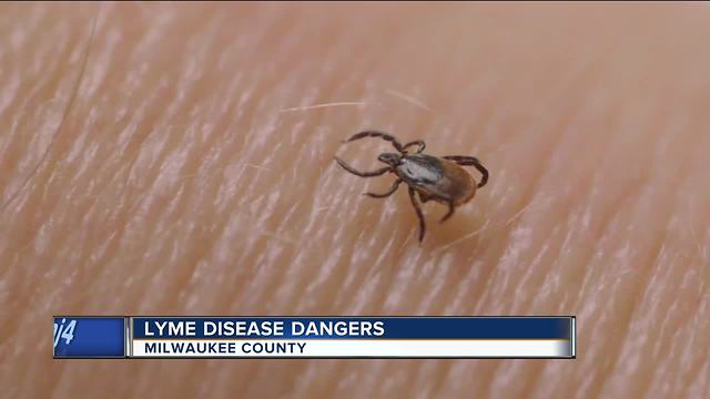 Wisconsin among worst states for Lyme Disease