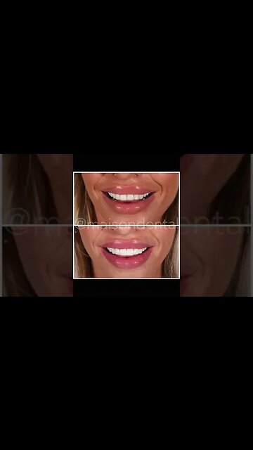 Dental And Teeth Hygiene