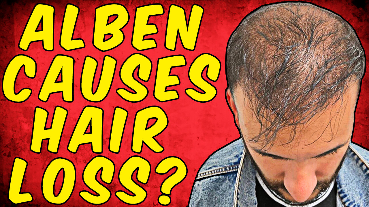 Can Albendazole Cause Hair Loss? - (Science Based)