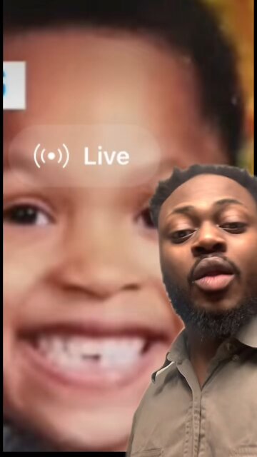 This BOY was in a COMA!!! #God #Jesus #fyp