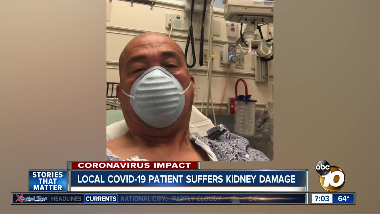 San Diego COVID-19 patient suffers kidney damage