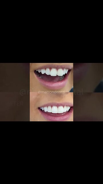 Dental And Teeth Hygiene