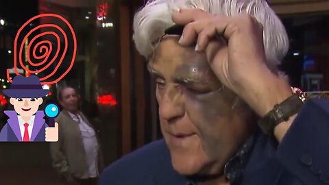 Shadow of Ezra - Jay Leno is an official member of the black eye club.