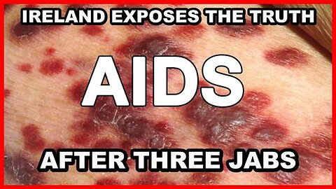 Ireland and other countries expose the truth that after THREE JABS, you will TEST POSITIVE for AIDS