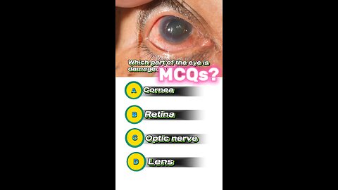 Glaucoma mcqs #mcqs #eye #anatomy 👀👁️‍🗨️🥽 #3dmedico