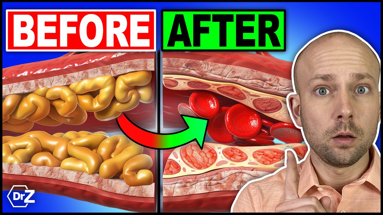 #1 Incredible Meal To Clean Out Your Arteries