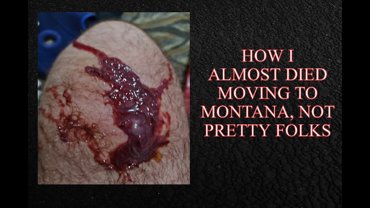 How MGTOW Philosopher Almost Died In Montana, & How You Can Help